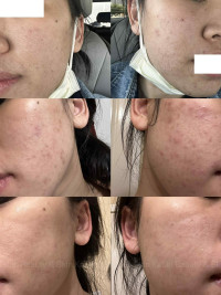 AnteAGE Pro System 30mL